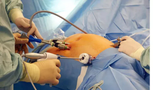 bariatric weight loss surgery